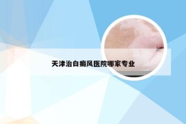 天津治白癜风医院哪家专业