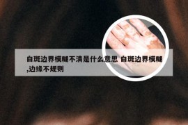 白斑边界模糊不清是什么意思 白斑边界模糊,边缘不规则