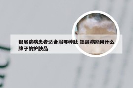 银屑病病患者适合服哪种肽 银屑病能用什么牌子的护肤品