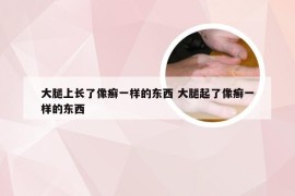 大腿上长了像癣一样的东西 大腿起了像癣一样的东西