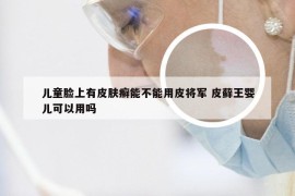 儿童脸上有皮肤癣能不能用皮将军 皮藓王婴儿可以用吗