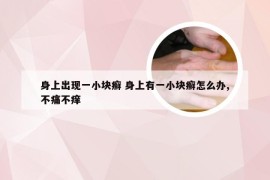 身上出现一小块癣 身上有一小块癣怎么办,不痛不痒