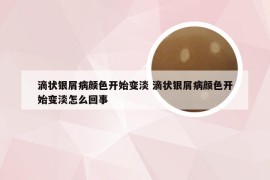 滴状银屑病颜色开始变淡 滴状银屑病颜色开始变淡怎么回事