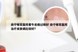 南宁哪家医院看牛皮癣过敏好 南宁哪家医院治疗皮肤病比较好?