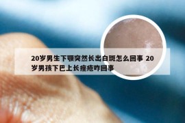 20岁男生下颚突然长出白斑怎么回事 20岁男孩下巴上长痤疮咋回事