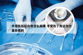 手受伤后起白斑怎么回事 手受伤了旁边为什是白色的