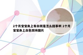 2个月宝宝身上有白斑是怎么回事啊 2个月宝宝身上白色斑块图片