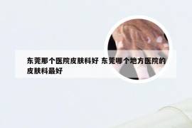 东莞那个医院皮肤科好 东莞哪个地方医院的皮肤科最好