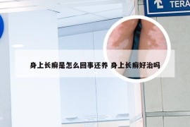 身上长癣是怎么回事还养 身上长癣好治吗