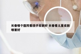 长春哪个医院看孩子皮肤好 长春看儿童皮肤哪里好