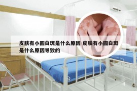 皮肤有小圆白斑是什么原因 皮肤有小圆白斑是什么原因导致的