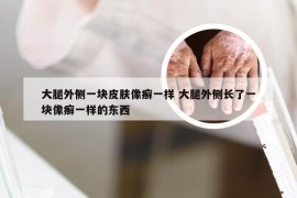 大腿外侧一块皮肤像癣一样 大腿外侧长了一块像癣一样的东西