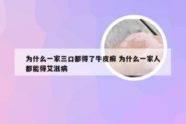 为什么一家三口都得了牛皮癣 为什么一家人都能得艾滋病