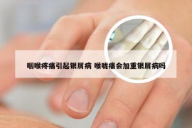 咽喉疼痛引起银屑病 喉咙痛会加重银屑病吗