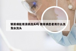 银屑病能用清扬洗头吗 银屑病患者用什么洗发水洗头