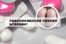 中国最好的银屑病医院在哪里 中国哪家医院治疗银屑病最好?