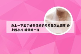 身上一下出了好多像癣的片片是怎么回事 身上起小片 就像癣一样