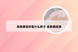 皮肤病见好是什么样子 皮肤病皮肤