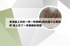 身体腿上长的一块一块像癣v样的是什么原因呢 腿上长了一块像癣的疙瘩