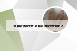 银屑病预防复发 银屑病预防复发的方法