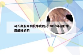 可长期服用的抗牛皮的药 2019年治疗牛皮最好的药