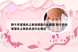 四个月宝宝头上有白斑是什么原因 四个月的宝宝头上有白点点什么情况