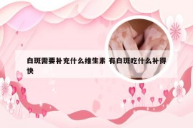 白斑需要补充什么维生素 有白斑吃什么补得快