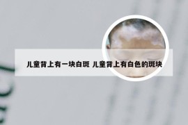 儿童背上有一块白斑 儿童背上有白色的斑块