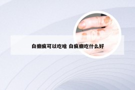 白癫疯可以吃啥 白疯癫吃什么好