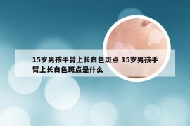 15岁男孩手臂上长白色斑点 15岁男孩手臂上长白色斑点是什么