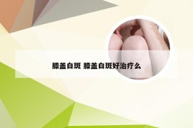 膝盖白斑 膝盖白斑好治疗么