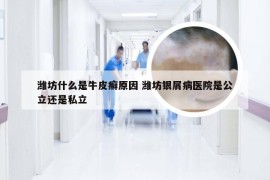 潍坊什么是牛皮癣原因 潍坊银屑病医院是公立还是私立