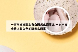 一岁半宝宝脸上有白斑怎么回事儿 一岁半宝宝脸上长白色的斑怎么回事