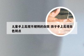 儿童手上出现不规则的白斑 孩子手上出现白色斑点