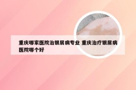 重庆哪家医院治银屑病专业 重庆治疗银屑病医院哪个好