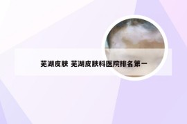 芜湖皮肤 芜湖皮肤科医院排名第一