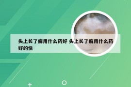 头上长了癣用什么药好 头上长了癣用什么药好的快