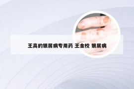 王高的银屑病专用药 王金校 银屑病