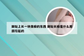 脚趾上长一块像癣的东西 脚趾长癣是什么原因引起的