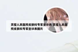 灵璧人民医院皮肤科专家坐诊表 灵璧人民医院皮肤科专家坐诊表图片