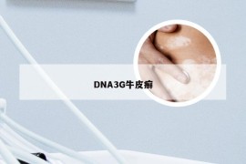 DNA3G牛皮癣