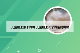 儿童脸上涨个白斑 儿童脸上长了白色的斑块