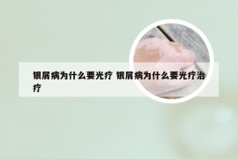 银屑病为什么要光疗 银屑病为什么要光疗治疗