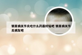 银屑病关节炎吃什么药最好贴吧 银屑病关节炎病友吧