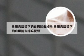 角膜炎后留下的白斑能去掉吗 角膜炎后留下的白斑能去掉吗视频