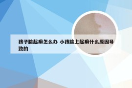 孩子脸起癣怎么办 小孩脸上起癣什么原因导致的