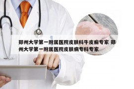 郑州大学第一附属医院皮肤科牛皮癣专家 郑州大学第一附属医院皮肤病专科专家