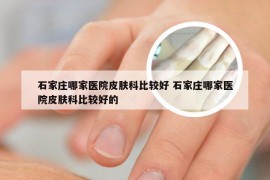 石家庄哪家医院皮肤科比较好 石家庄哪家医院皮肤科比较好的