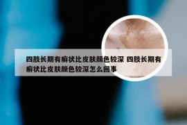 四肢长期有癣状比皮肤颜色较深 四肢长期有癣状比皮肤颜色较深怎么回事