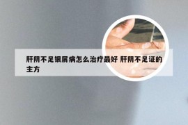 肝阴不足银屑病怎么治疗最好 肝阴不足证的主方